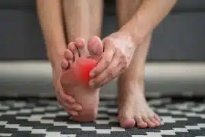 Plantar-Fasciitis