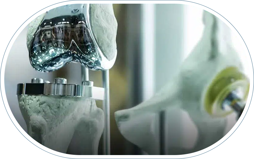 Knee replacement prosthetics in an orthopedic surgeon office.