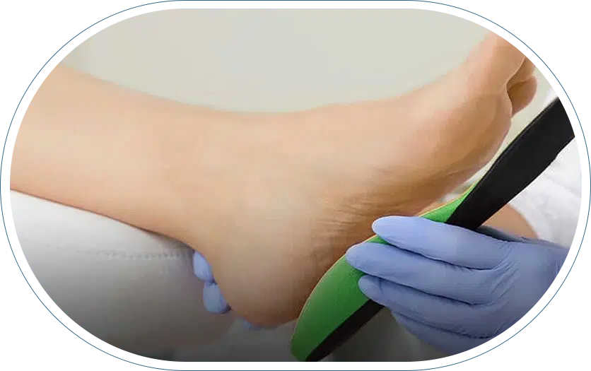 Foot getting fitted for custom orthotics.