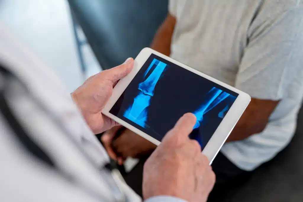 Fracture Treatment in Baltimore