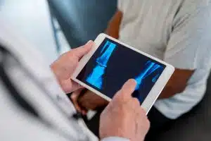 Fracture Treatment in Baltimore