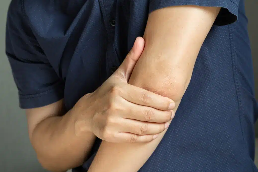 Man touching the elbow with tennis elbow pain And he relieves pain with massage.